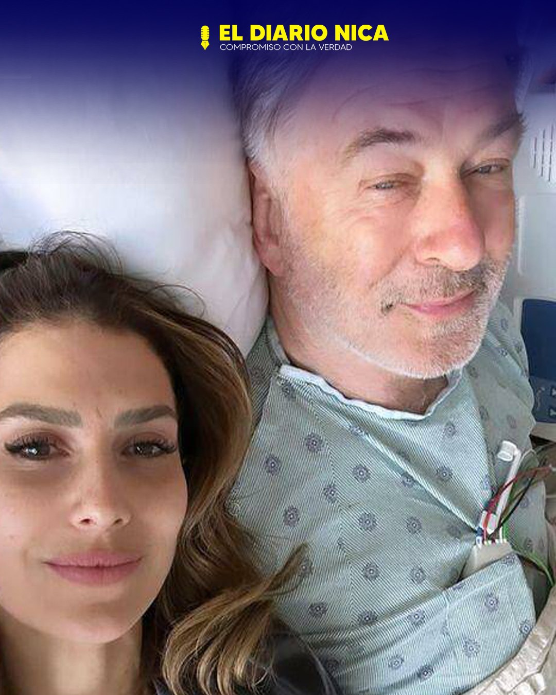 Alec Baldwin es intervenido quirúrgicamente