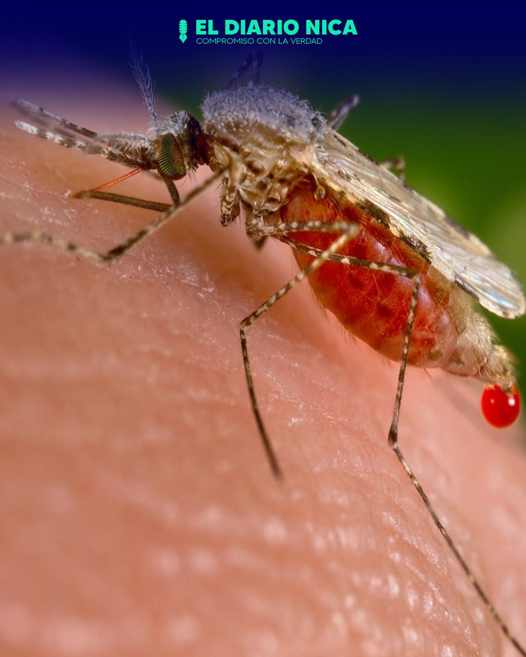 Belice declarado país libre de malaria