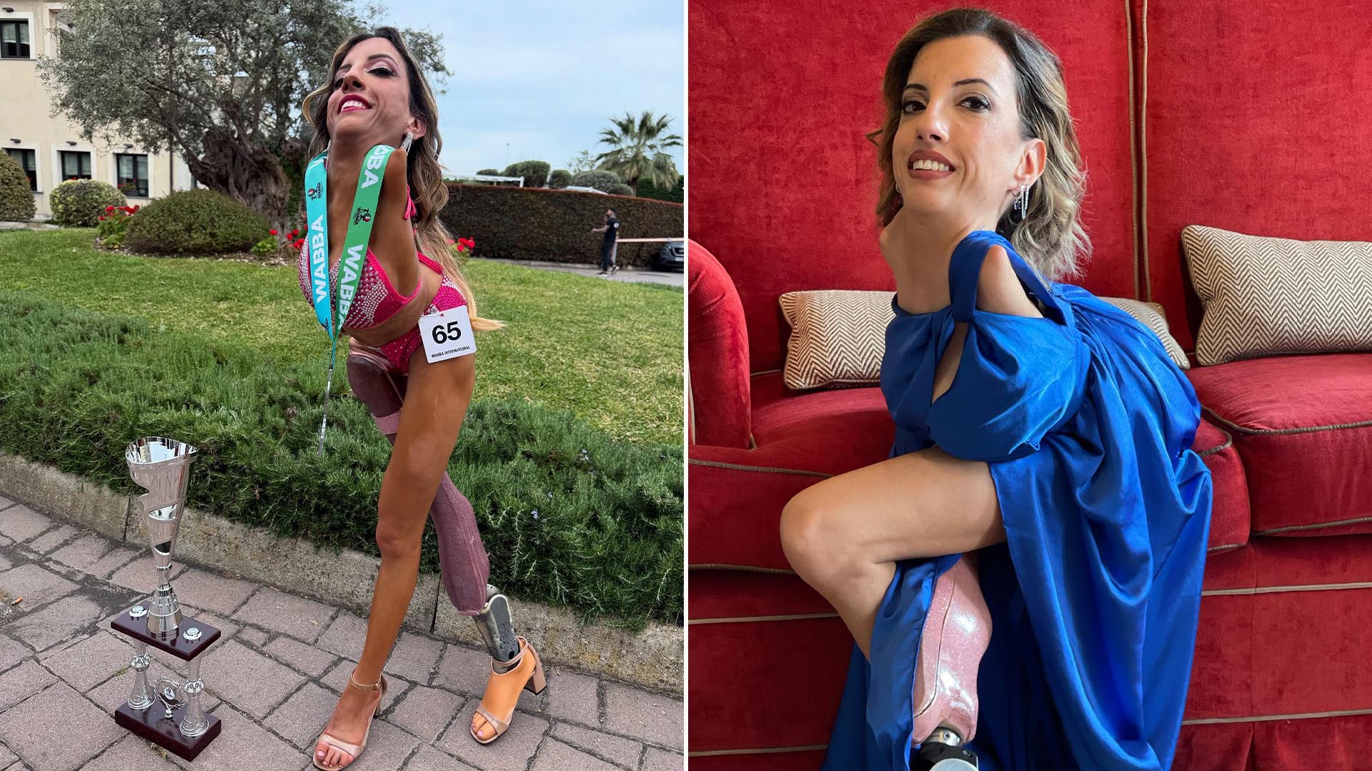 Influencer con prótesis motiva en redes sociales