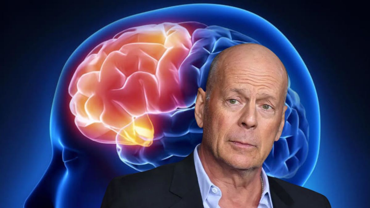 Familia de Bruce Willis donará su cerebro a la ciencia